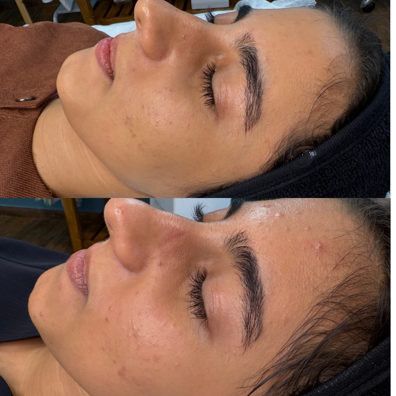 خدمات تخصصی پوست و فیشال سمانه ابراهیمی