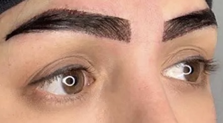 کاشت مو و ابرو تخصصی پردیس