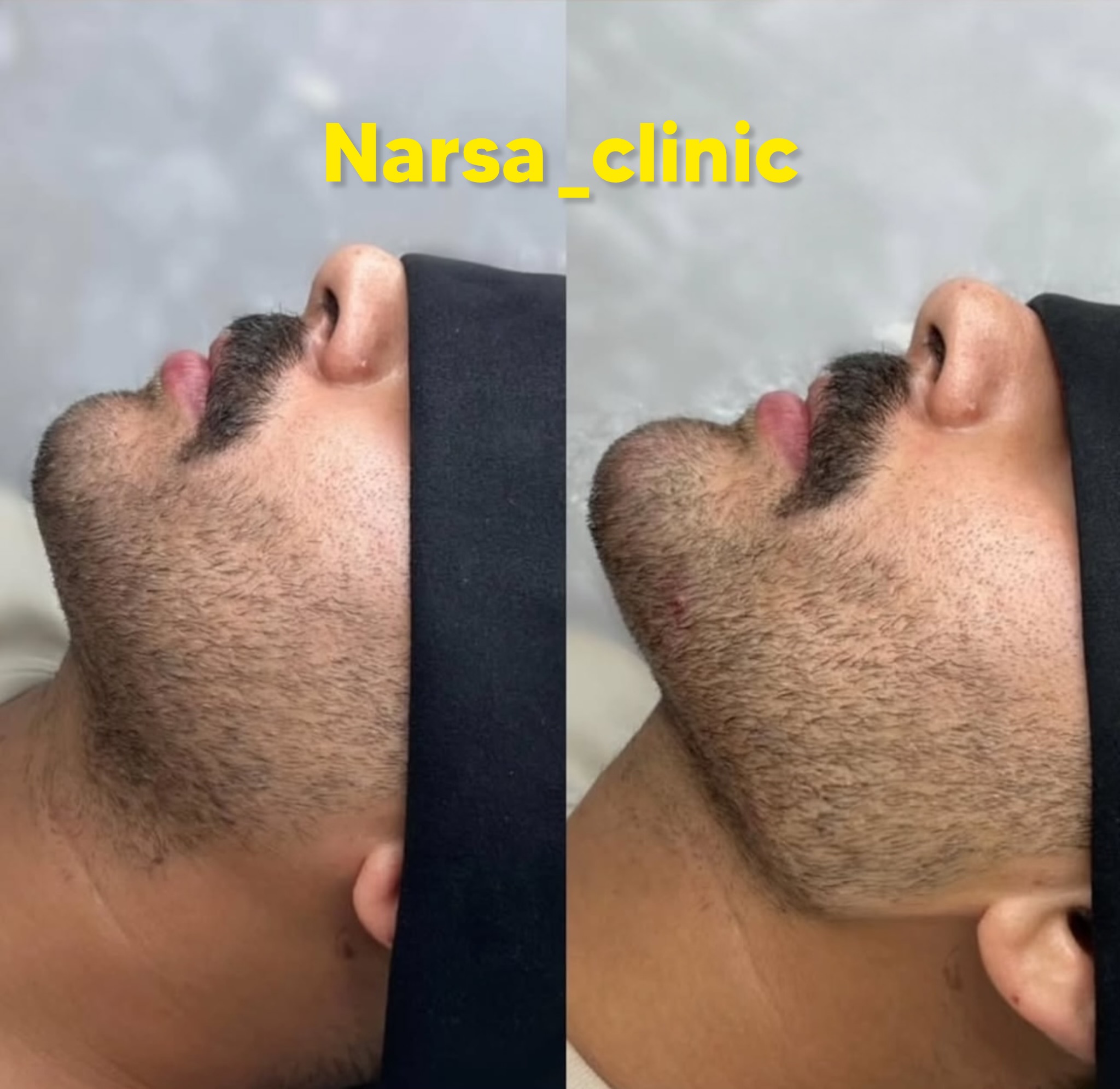 کلینیک پوست مو زیبایی فیلر بوتاکس نارسا