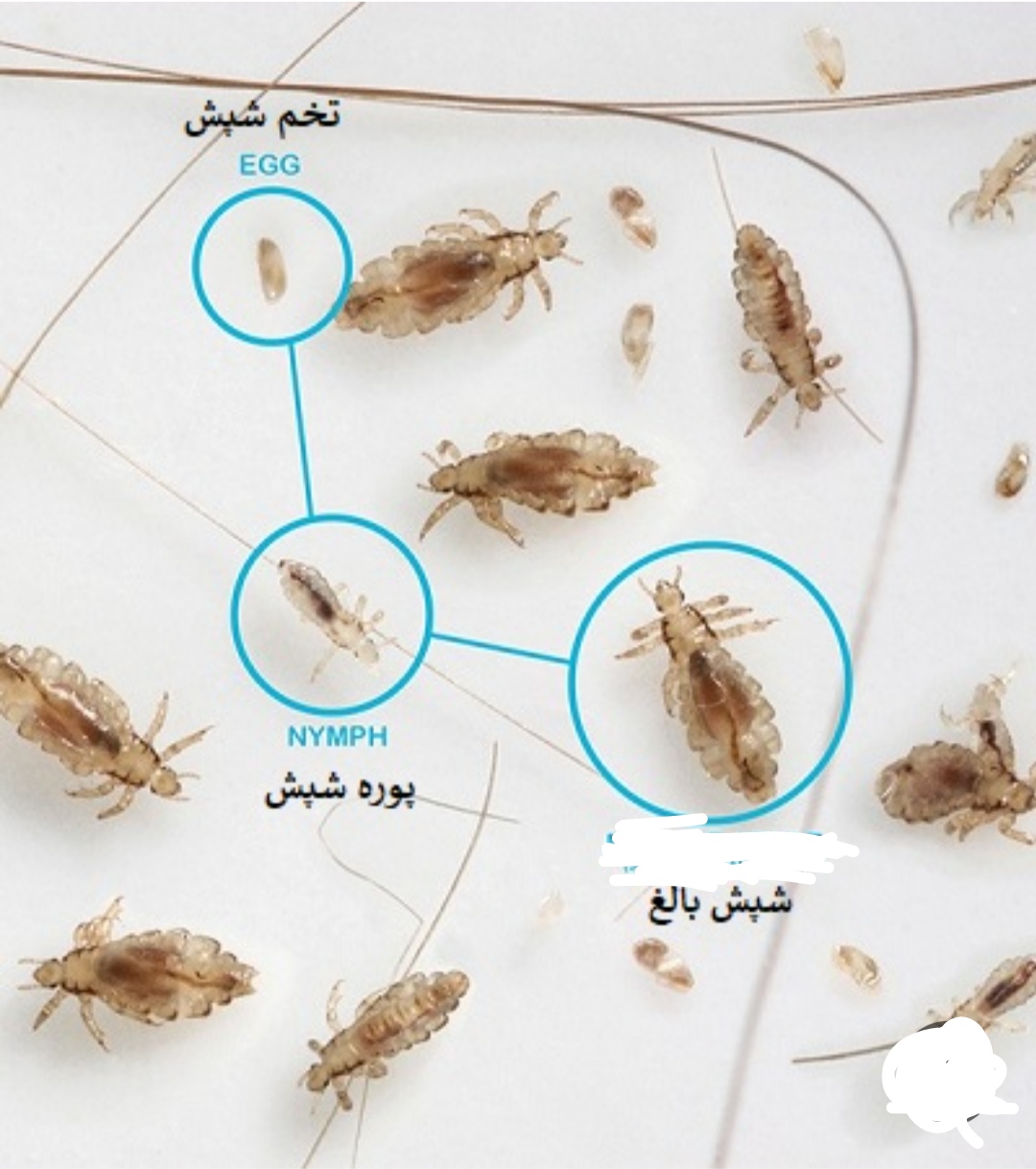 درمان قطعی و پاکسازی تضمینی شپش