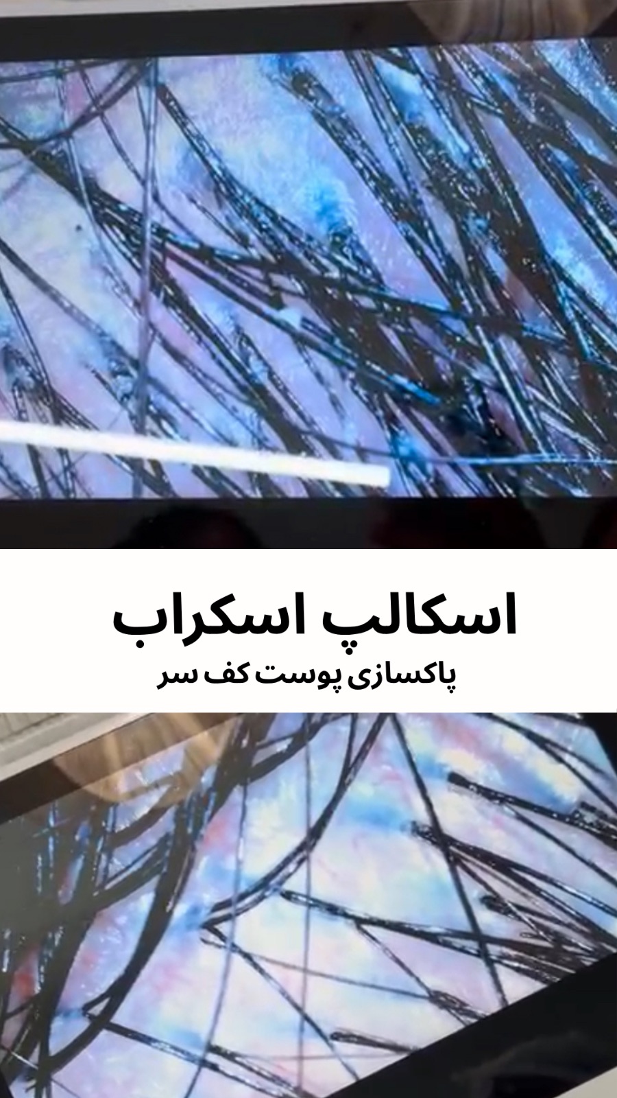 مرکز تخصصی اسکالپ و فیشال دینا شبانی