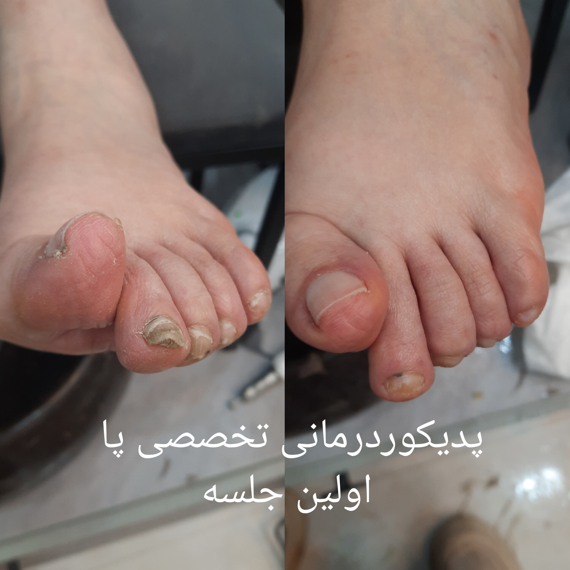 سالن اپیلاسیون نیره - آمل - 3361