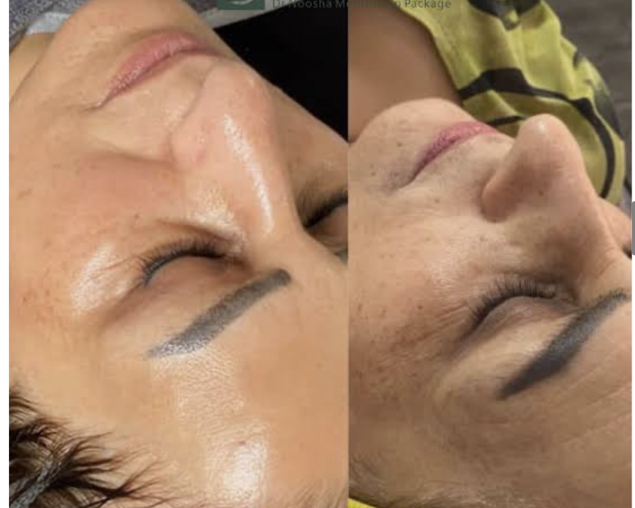 کلینیک تخصصی فیشال واسکراب اسکالپ مهرو