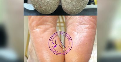 پدیکور قم| فاطمه محمدی