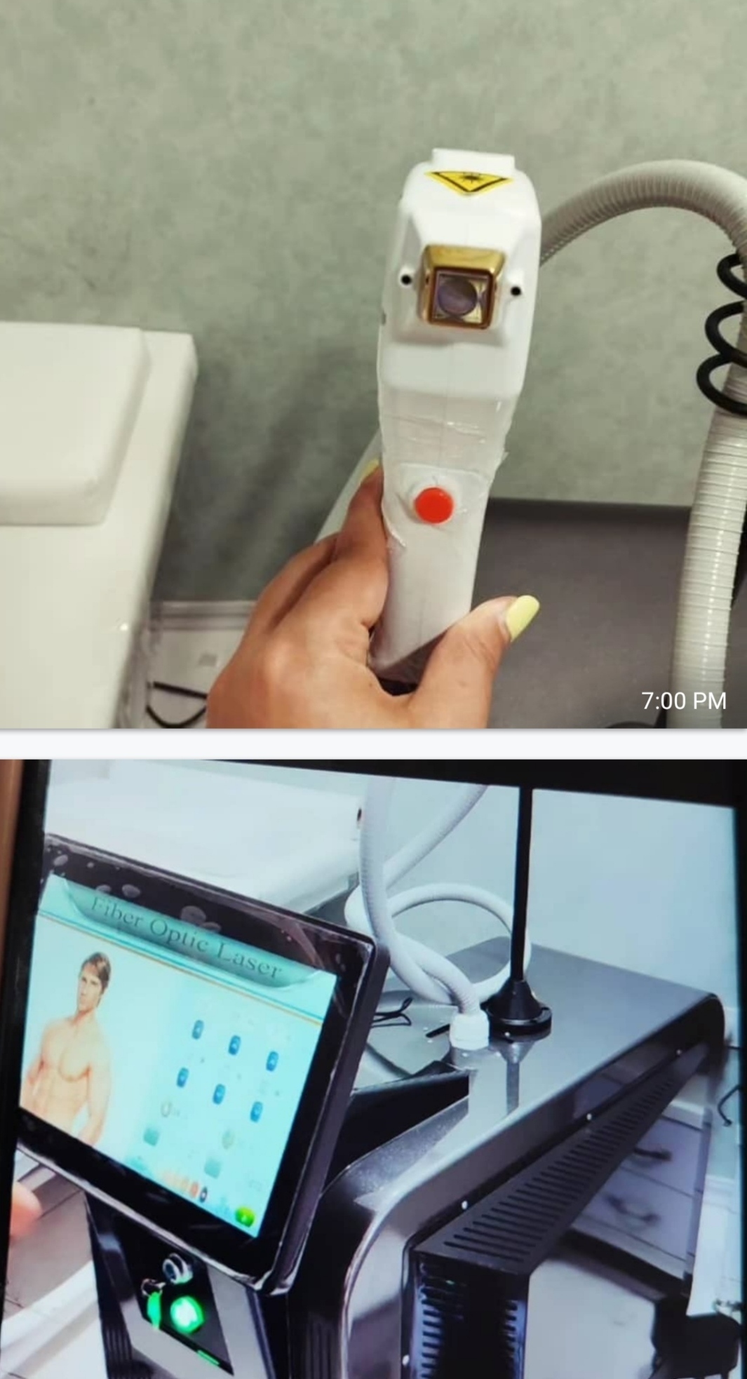 لیزر موهای زاید امیدورار