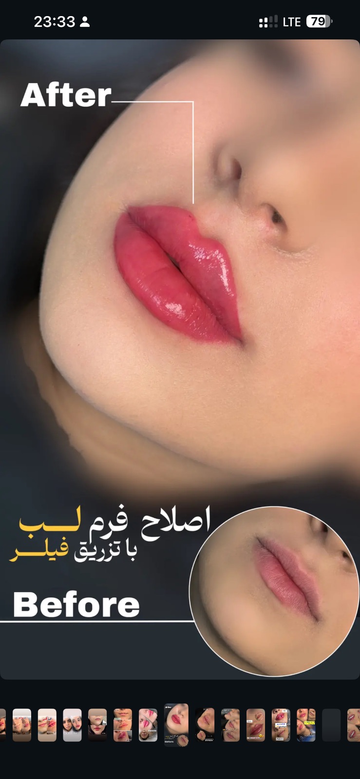 کلینیک لیزر و زیبایی مهسان
