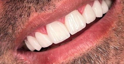 دندانپزشکی و ترمیم زیبایی