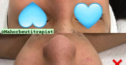 فشیال پوست حلیمه