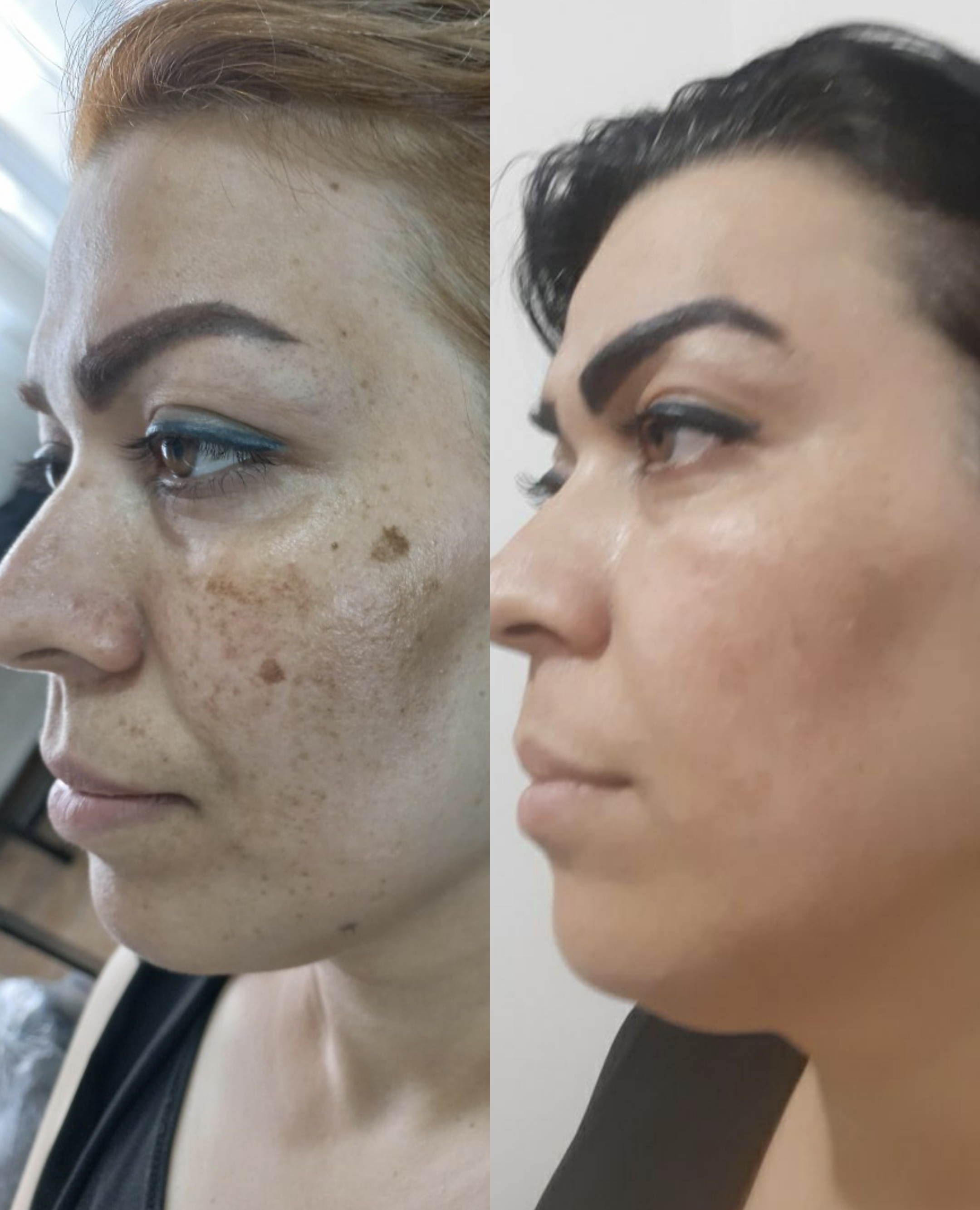 Skincar.azar فیشیال