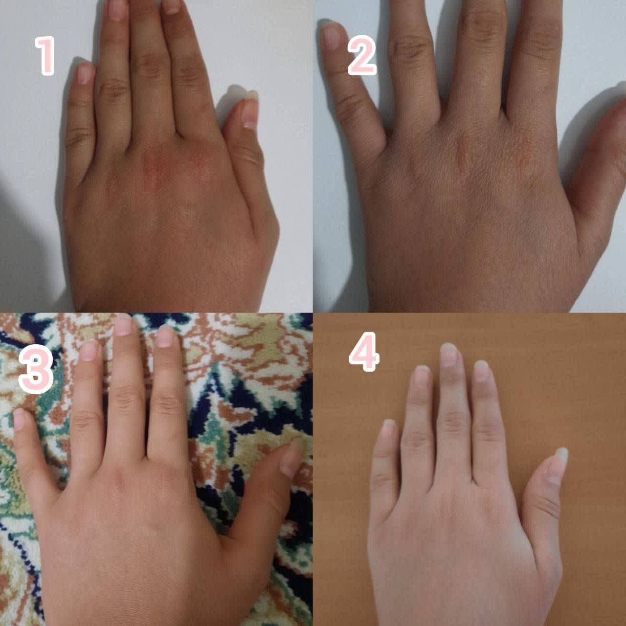 خدمات فیشال پاکسازی، اسکالپ اسکراپ ماهرخ