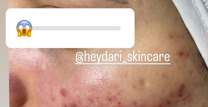 بیوتی تراپیست