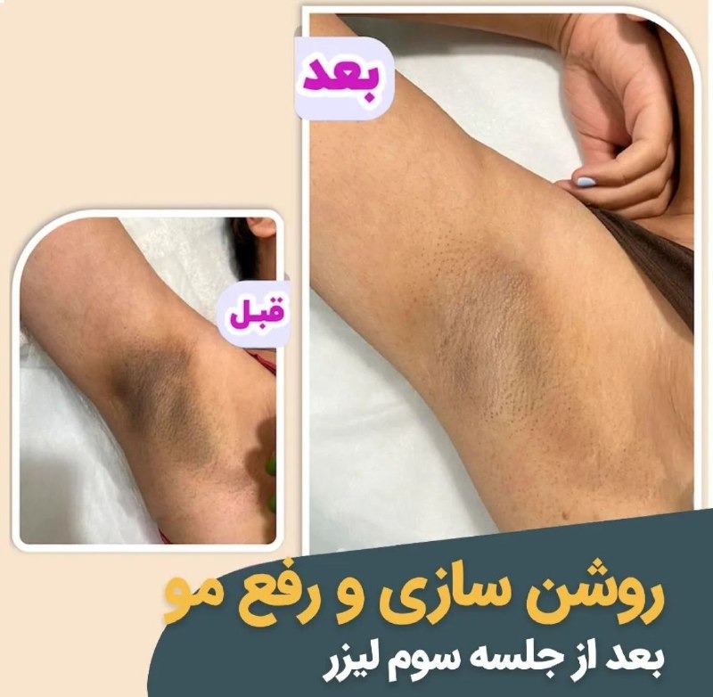 مرکز لیزر روز دنیا