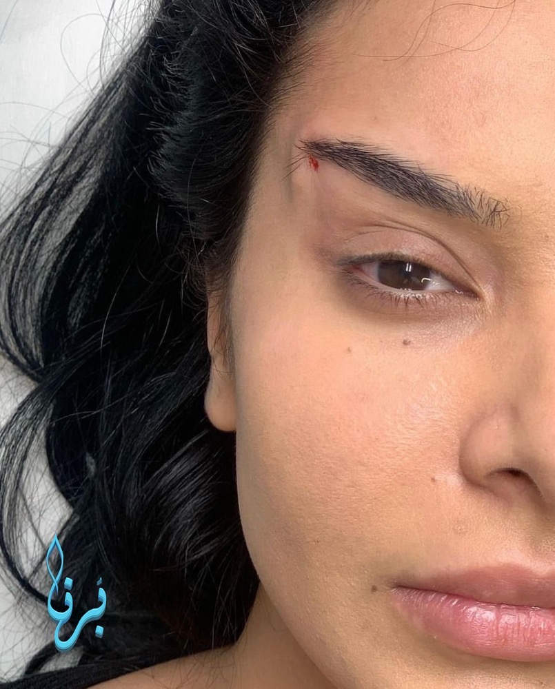 کلینیک زیبایی برنا