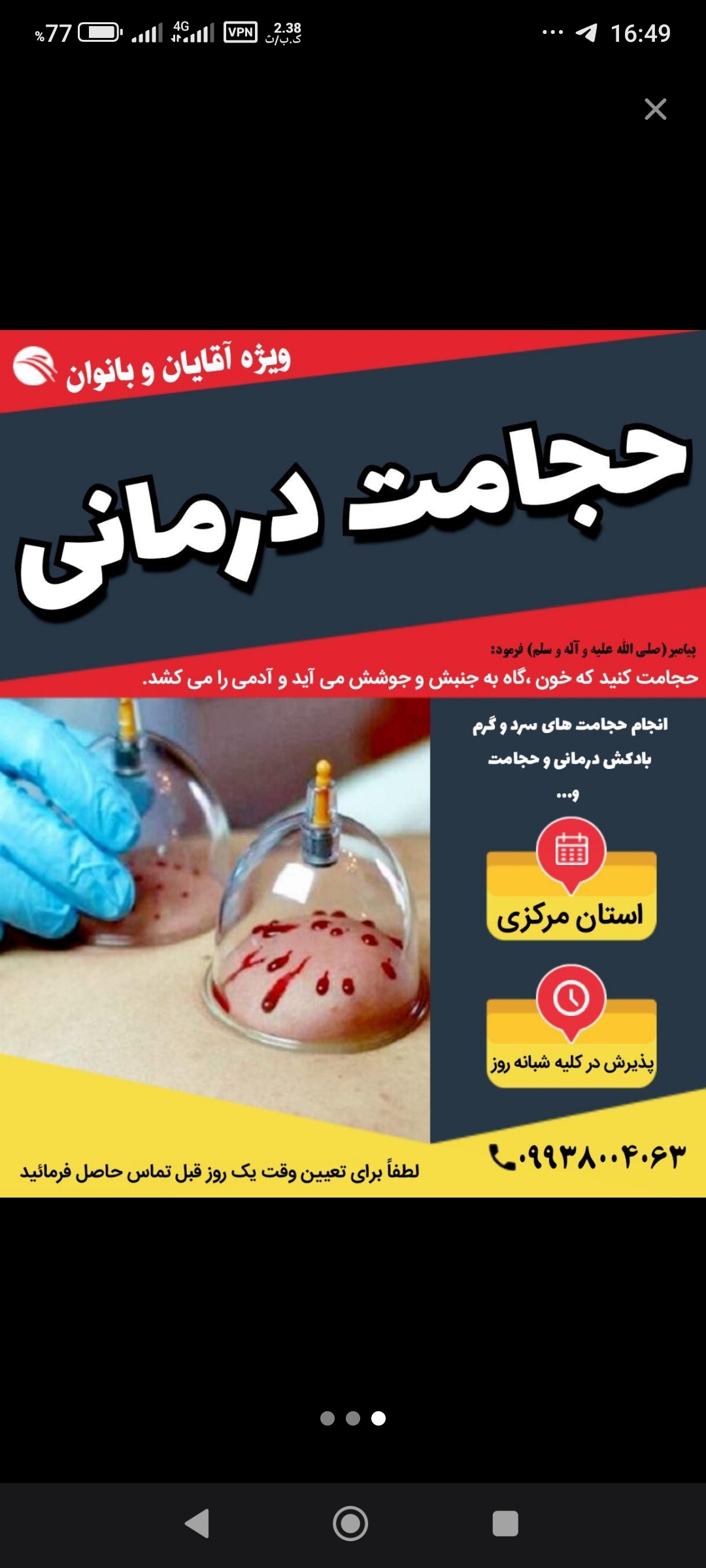 حجامت کمانی