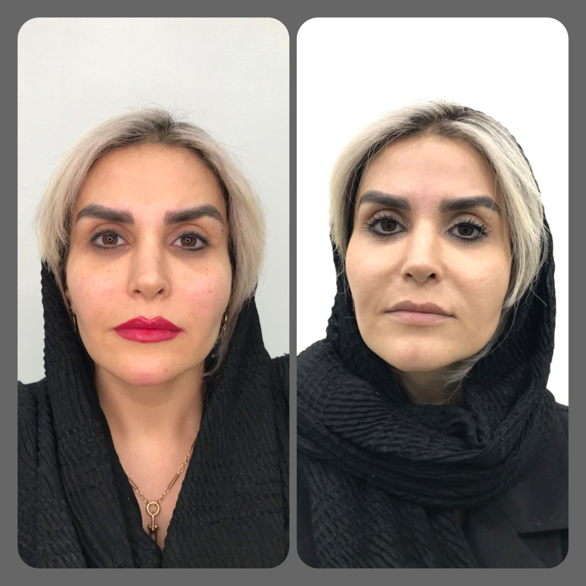 کلینیک لیزر و زیبایی مهرُنا