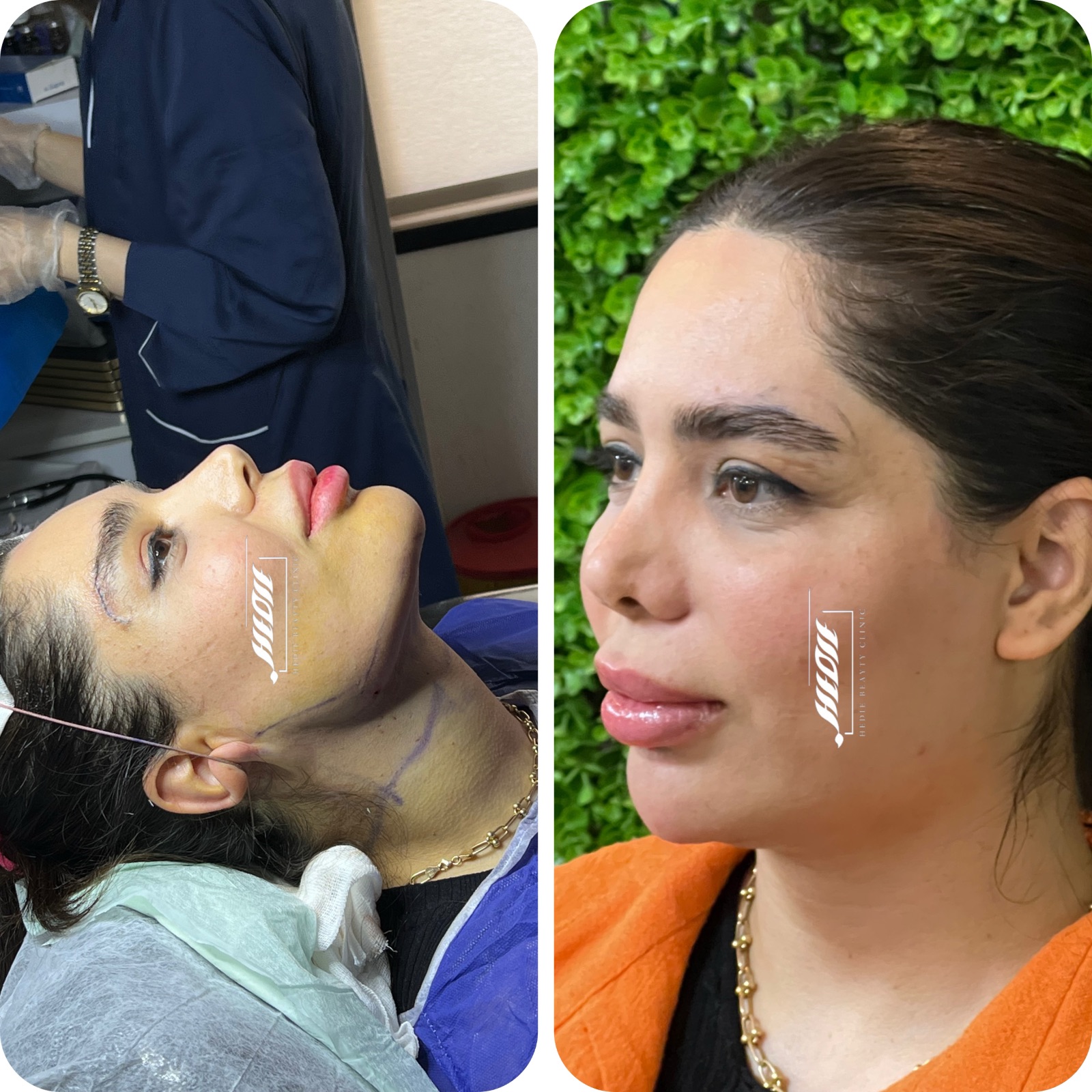 کلینیک زیبایی هدیه