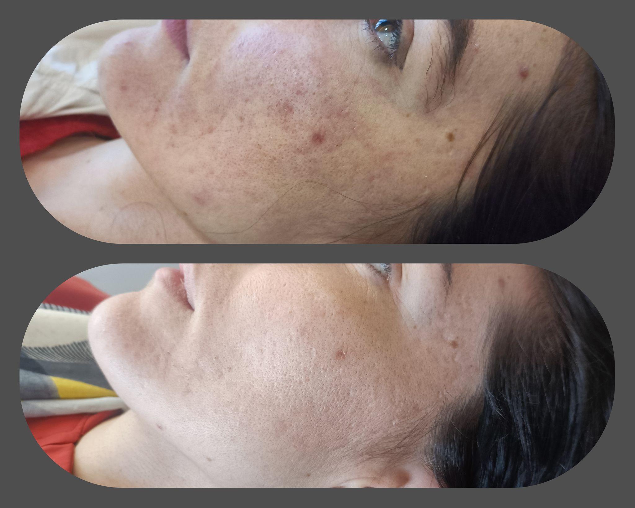 کلینیک زیبایی، لیزر، لاغری دُریتا