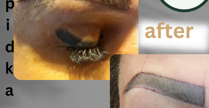 کاشت مو وابرو طبیعی سپیدکاشت