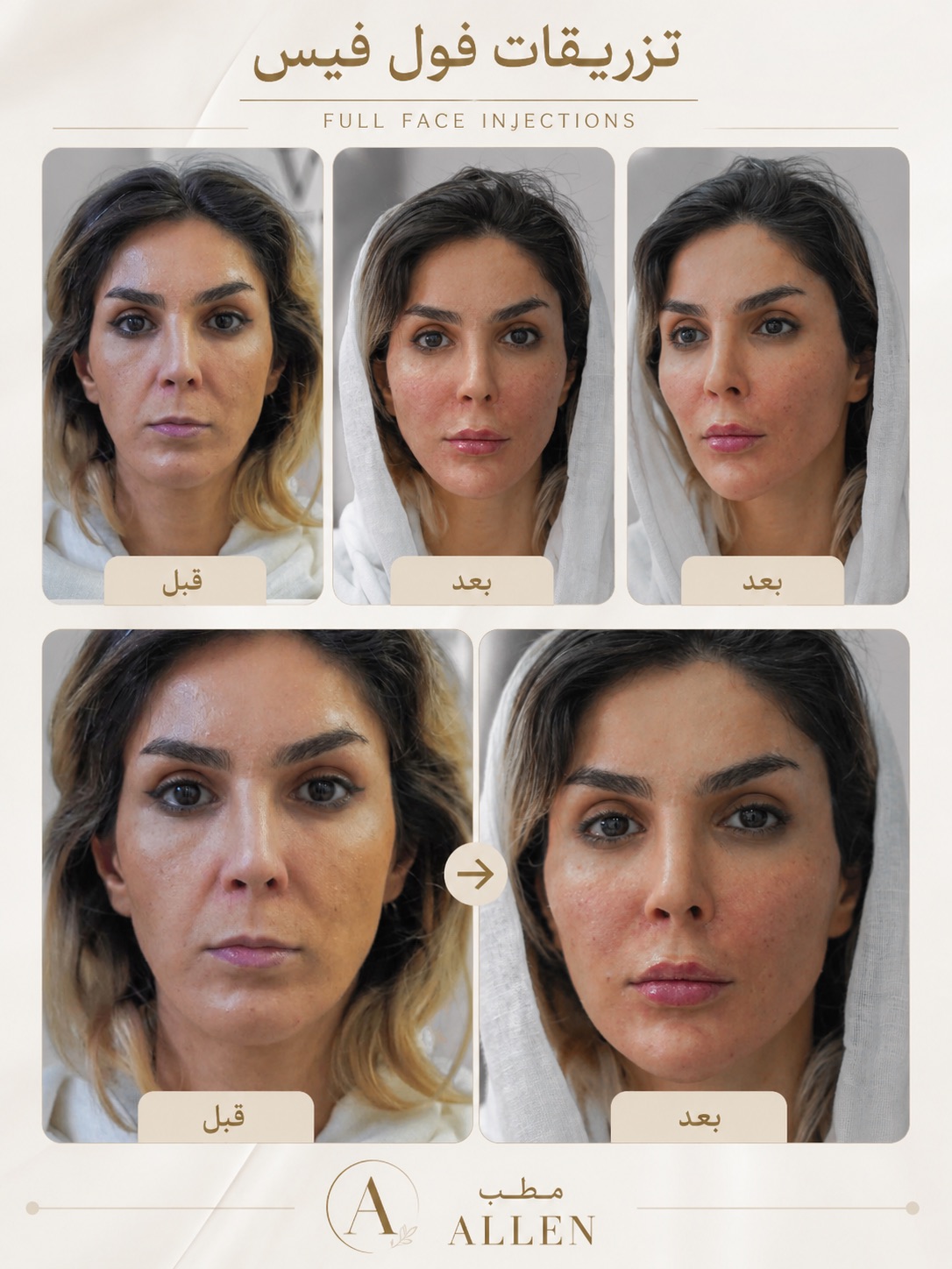 کلینیک زیبایی پوست و لیزر آلن