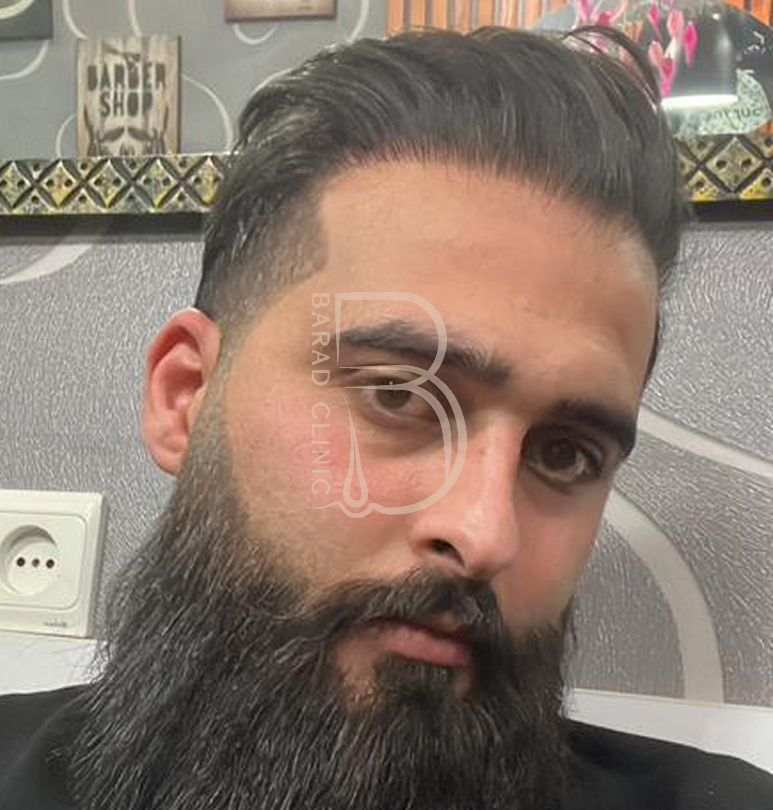 کلینیک پوست مو و زیبایی و کاشت مو باراد