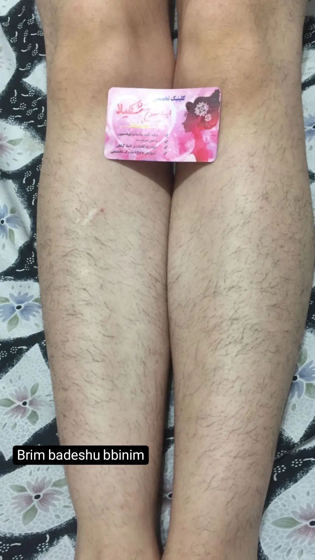 خدمات وکس شکیلا