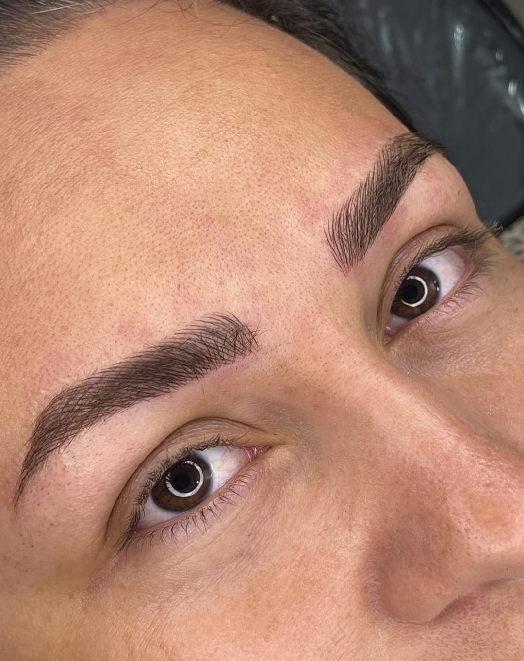 میکروبلیدینگ و شیدینگ لب محدثه