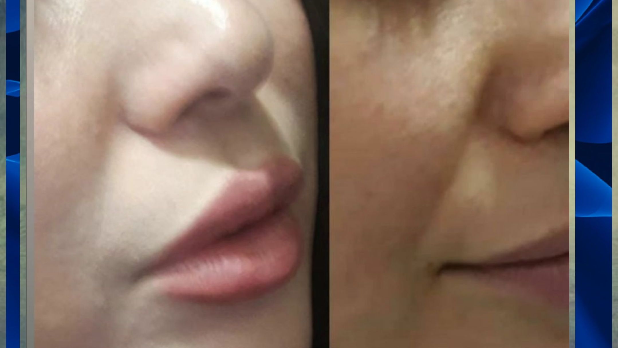 متخصص زیبایی دکتر سید حسن مظلومی