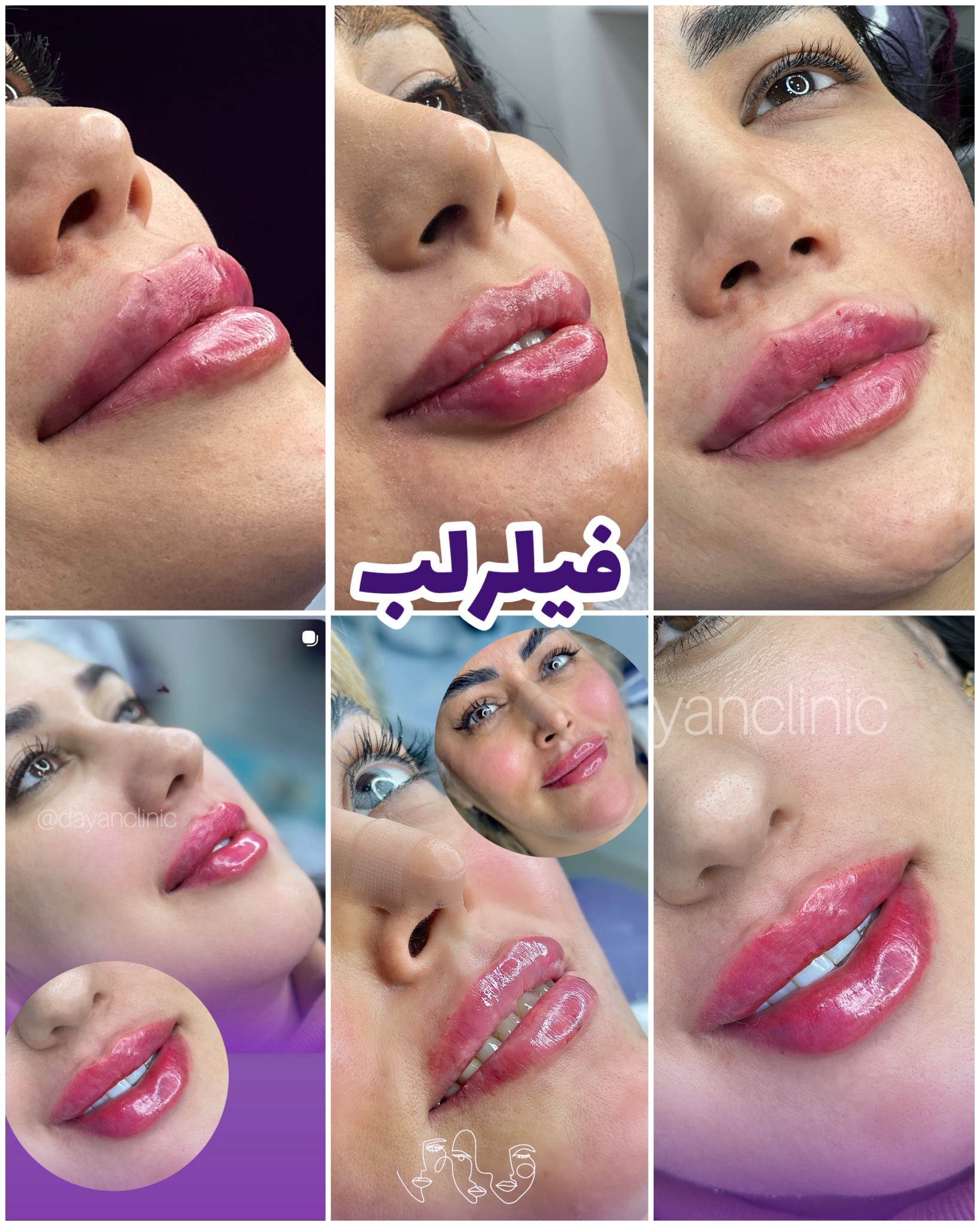 کلینیک لیزر و زیبایی دایان