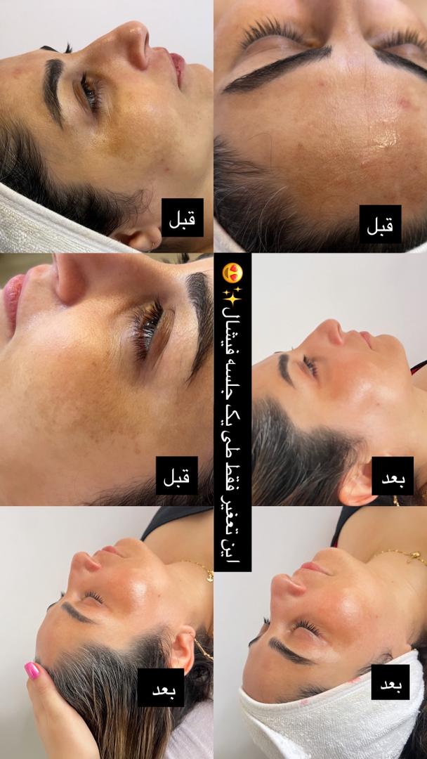 کلینیک لیزر و زیبایی ققنوس