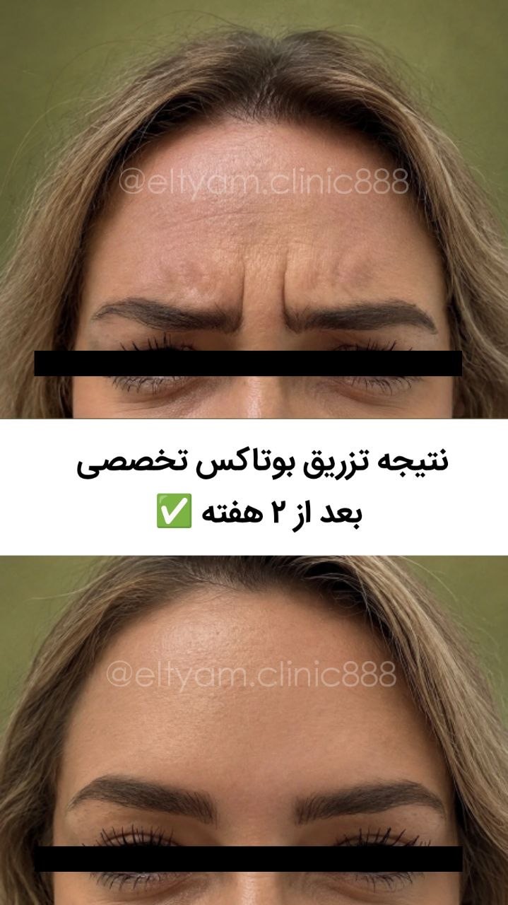 کلینیک زیبایی التیام