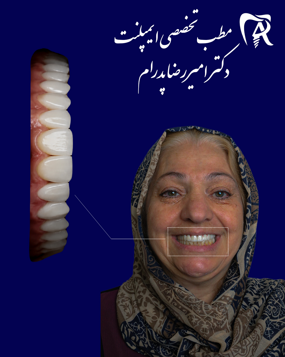 دندانپزشکی دیجیتال دکتر امیررضا پدرام