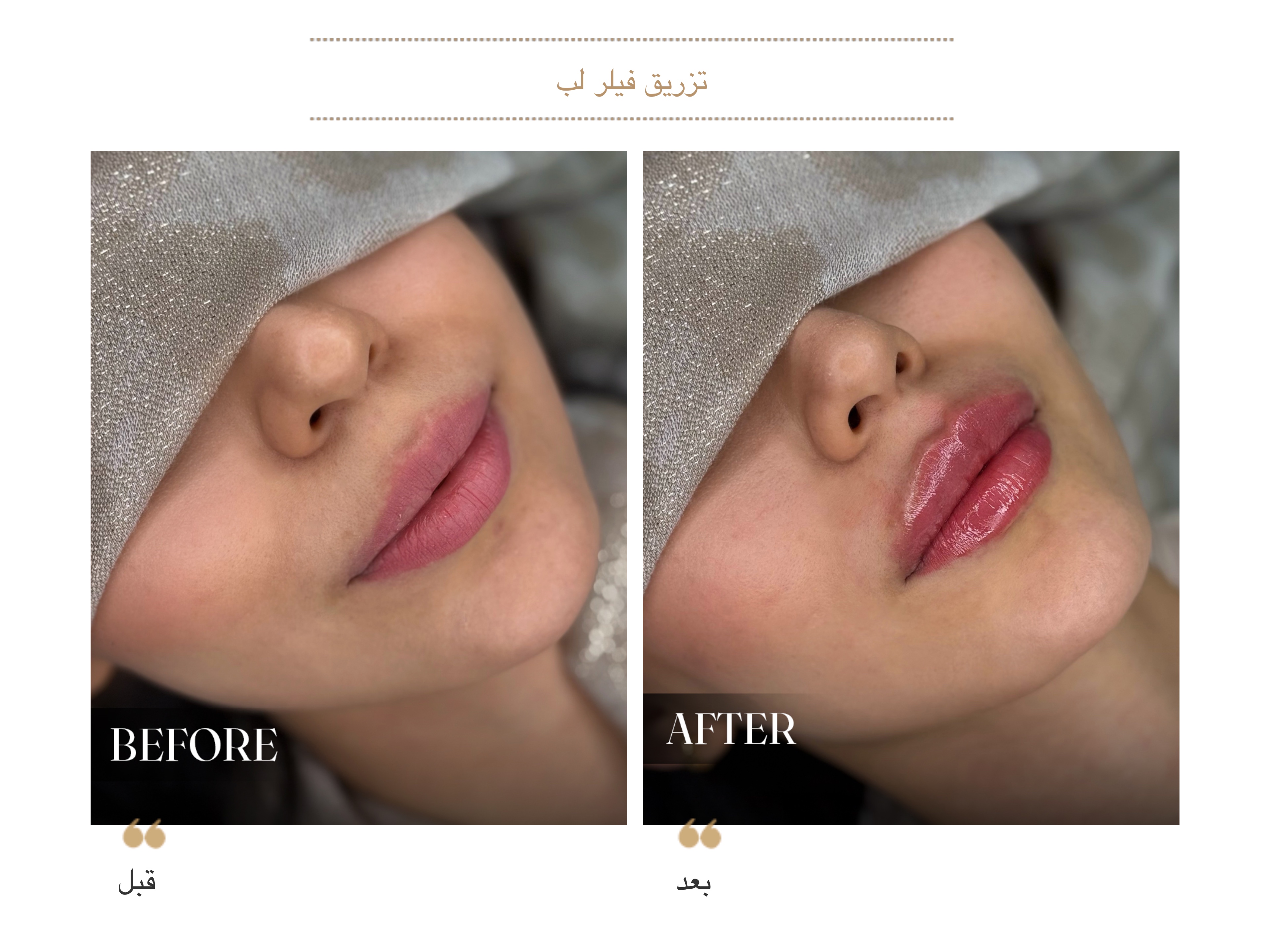 مرکز لیزر و کلینیک زیبایی دکتر با حجب