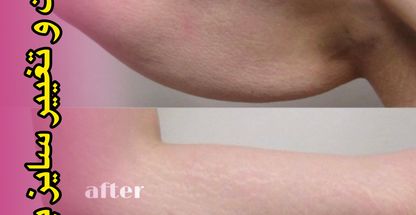 مرکز زیبایی، لیزر و تناسب اندام لبخند