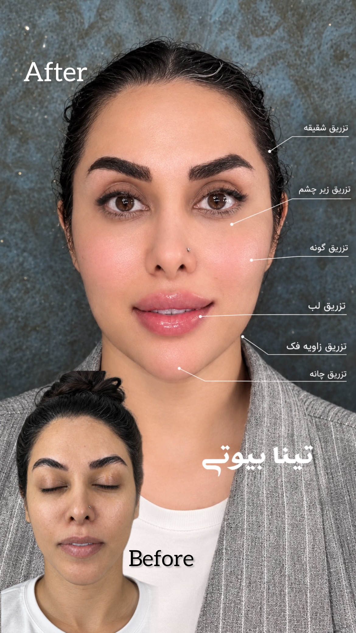 Tina Beauty Center|مرکز زیبایی تینابیوتی