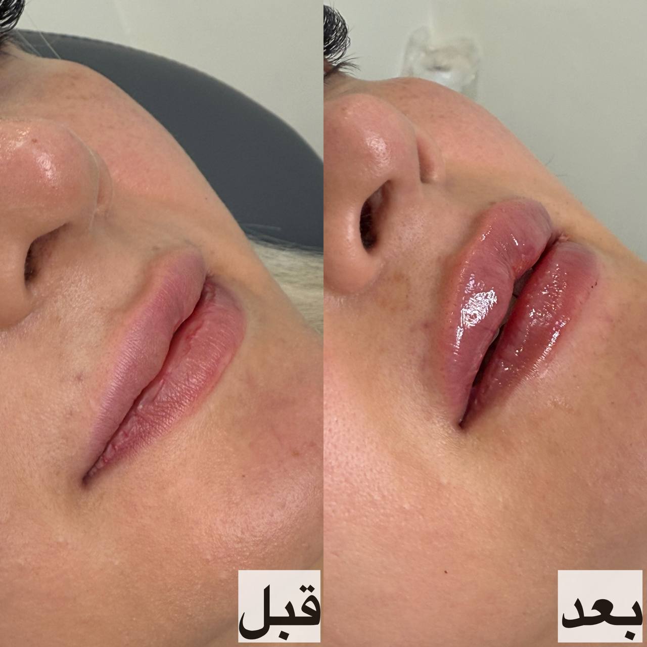 کلینیک پوست،مو،لیزر الیزا