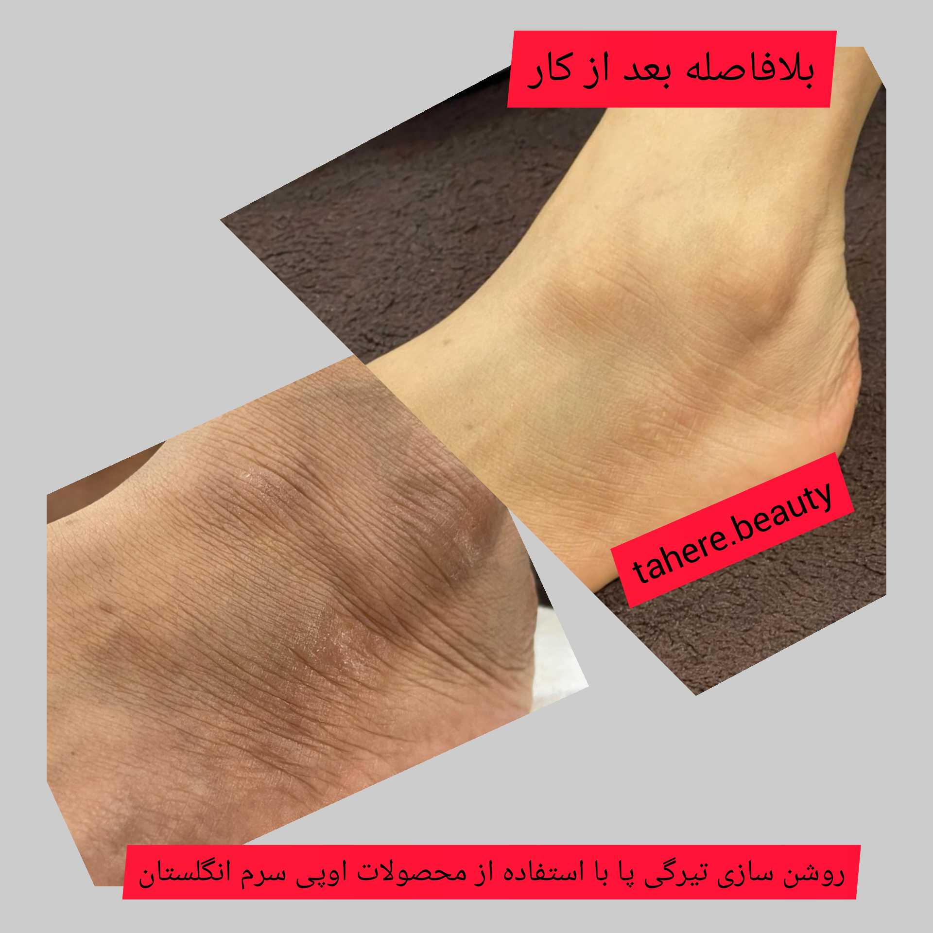 فیشال تخصصی طاهره بیوتی