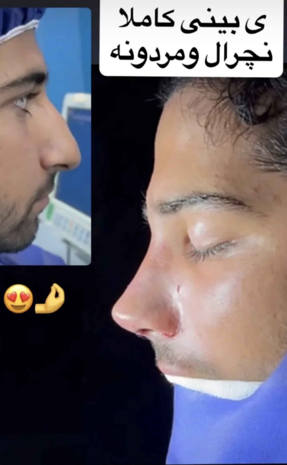 دکتر محمود قهقایی فوق تخصص جراحی پلاستیک