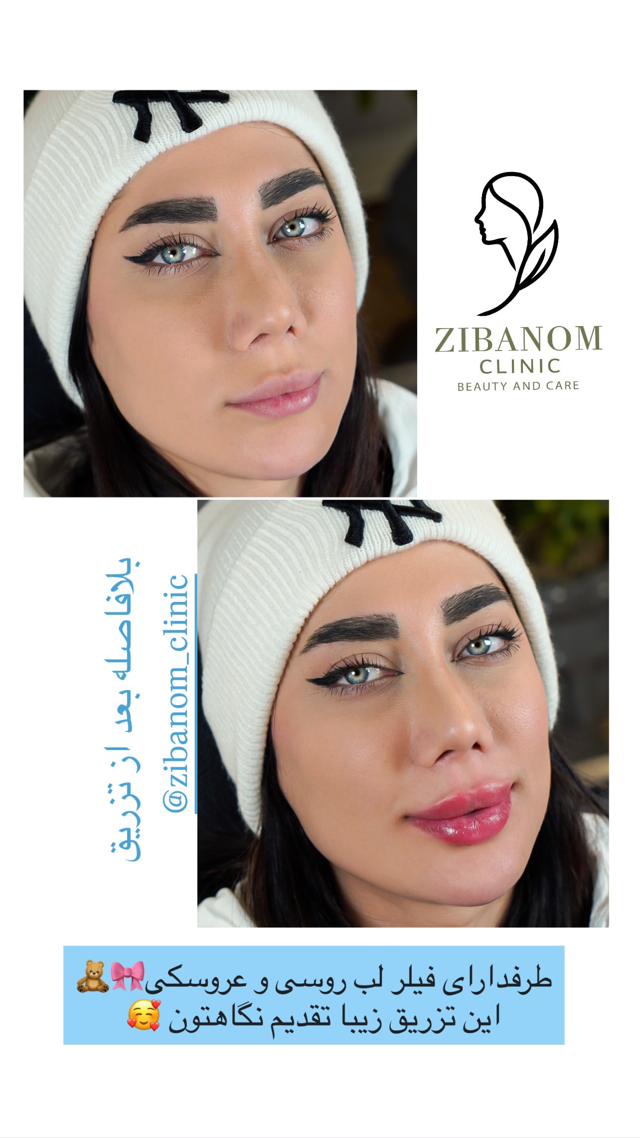کیلینیک زیبا نوم