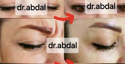 خدمات زیبایی در کلینیک دکتر ابدال