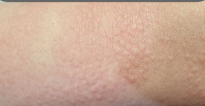 مرکز لیزر زیبایی گیسو (شریعتی میرداماد)