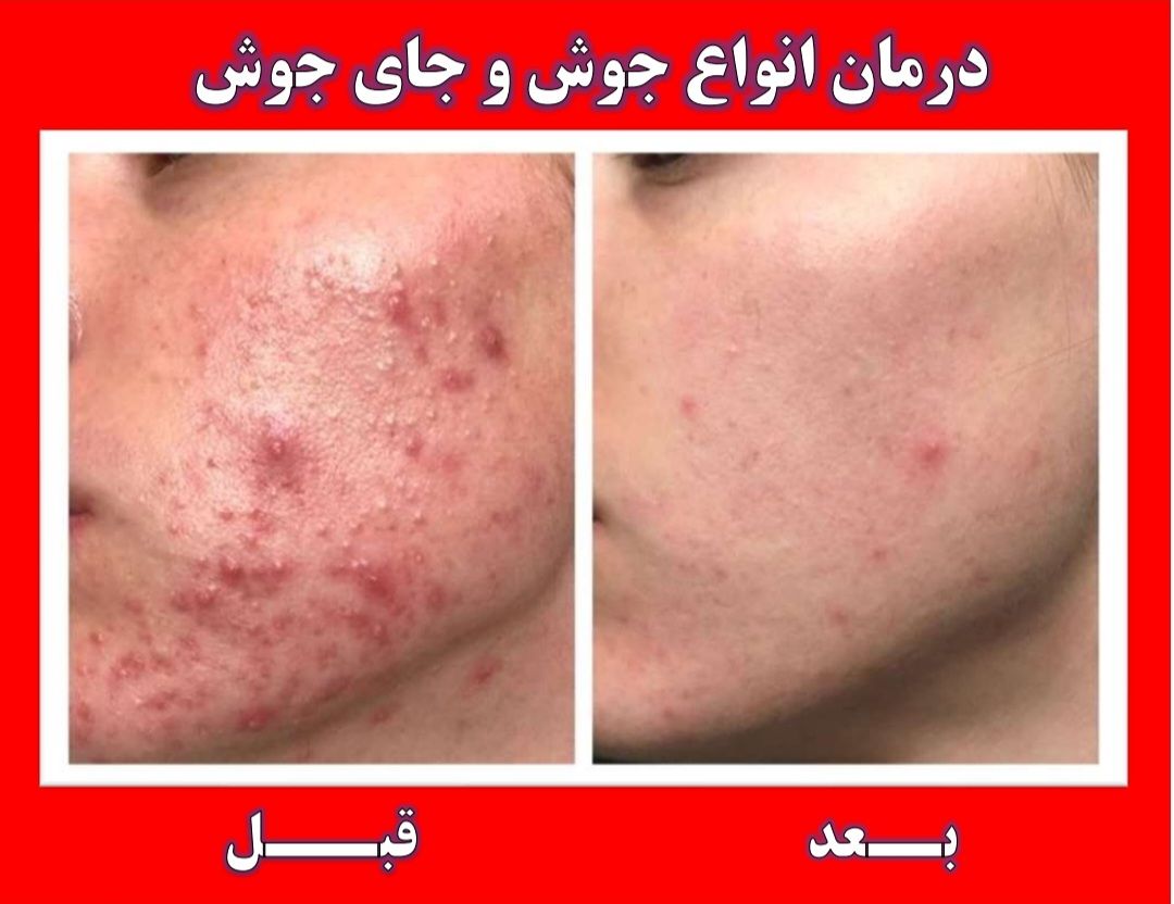 درمان تخصصی انواع عارضه پوست و مو