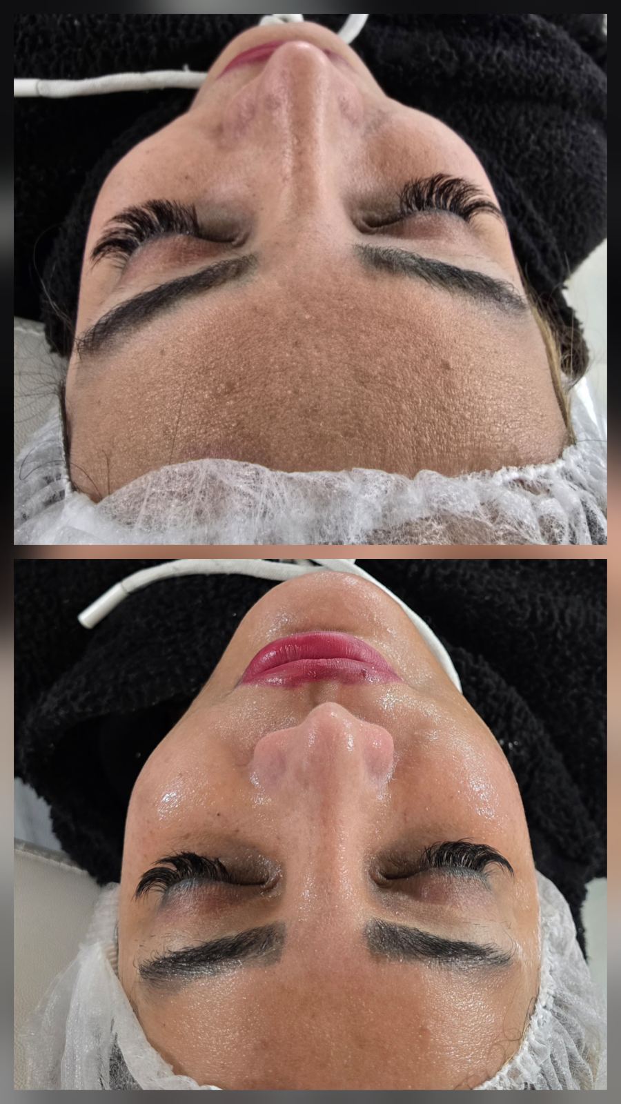 فیشیال و خدمات پاکسازی پوست الهام اورا