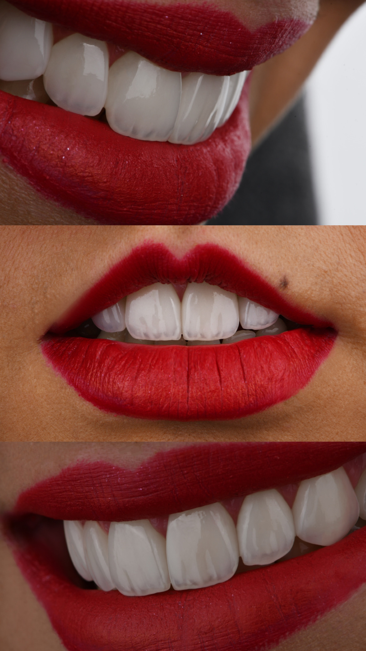 دندانپزشکی زیبایی دکتر محمد خسروی