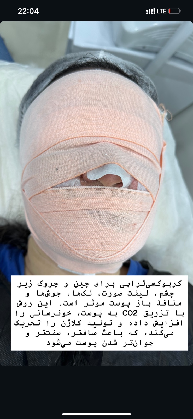 خدمات پاکسازی و فیشیال