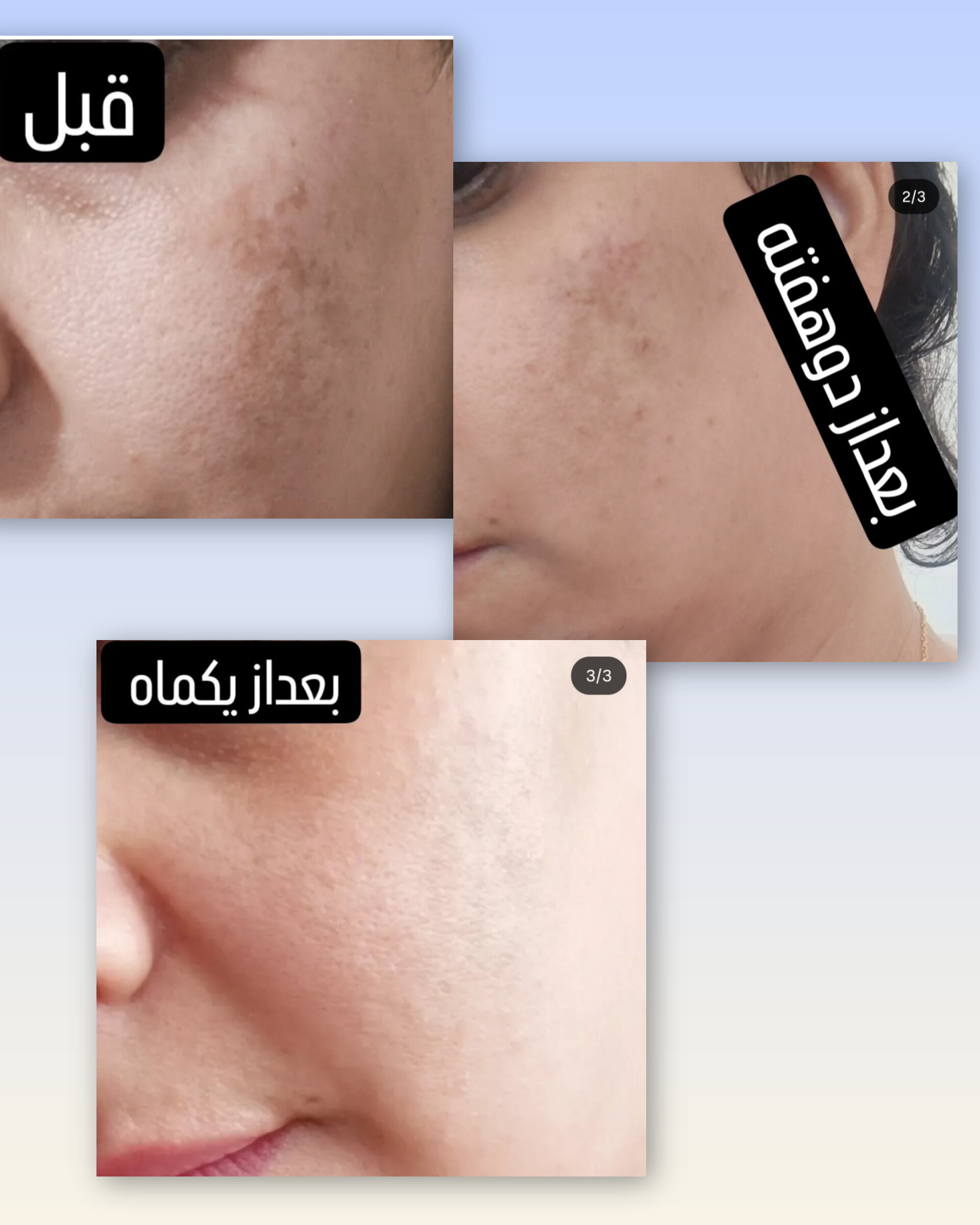 فیشیال تخصصی کلینیک زیبایی کوروش
