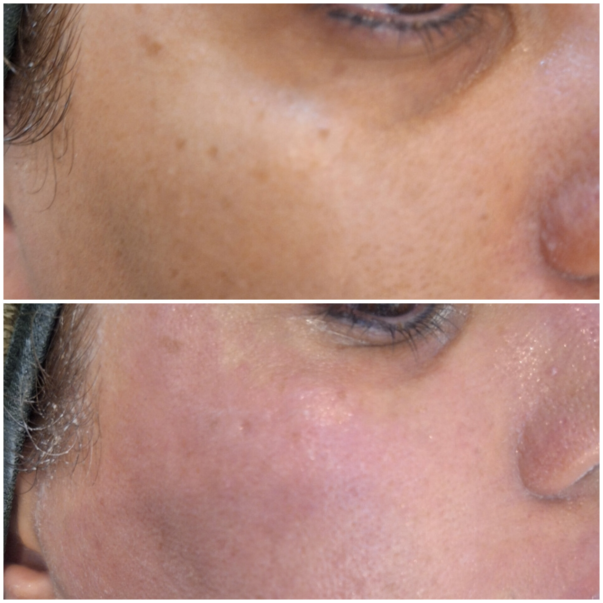 درمانگر پوست زهره مهرابی