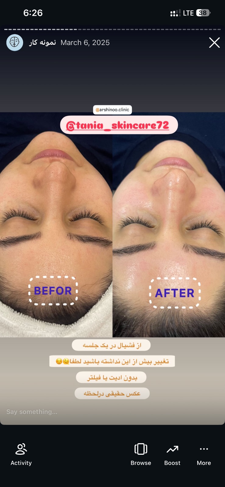 خدمات فیشیال و پاکسازی پوست