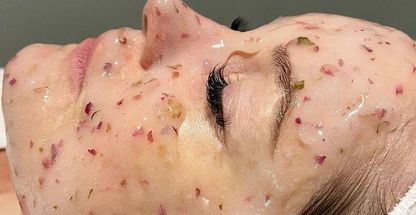 فیشال تخصصی و درمان مشکلات پوستی