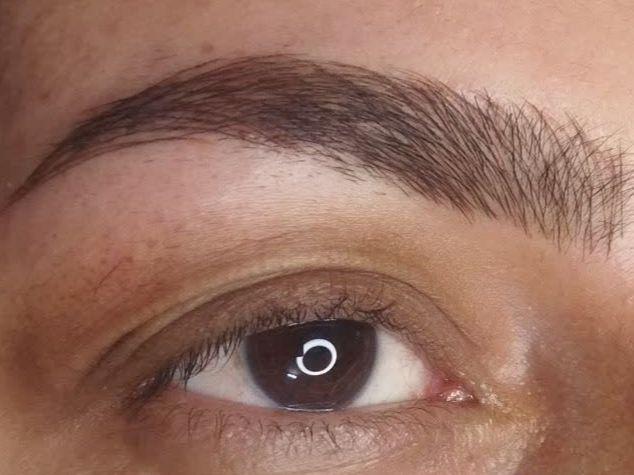 میکروبلیدینگ . نانوبروز.فیبروز کانتوربروز