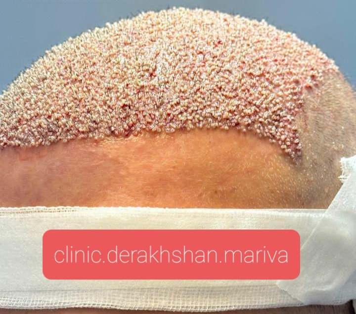 کلینیک تخصصی پوست و مو دکتر درخشان